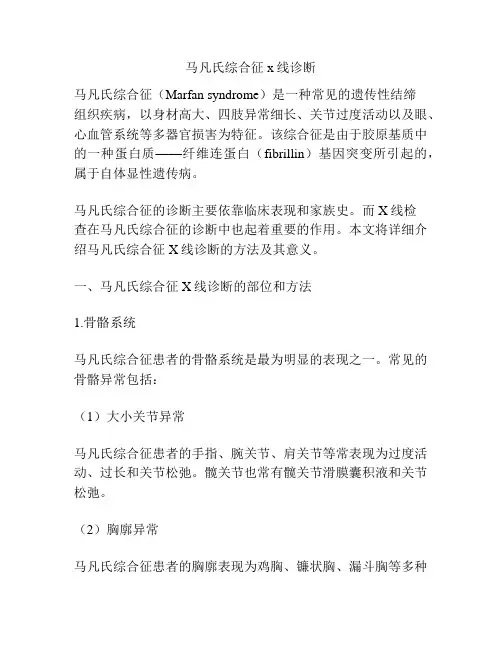 马凡氏综合征x线诊断