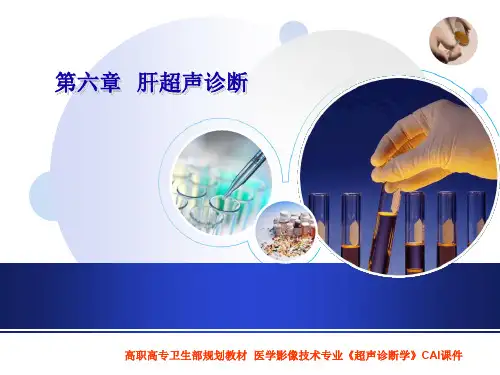 肝超声诊断  ppt课件
