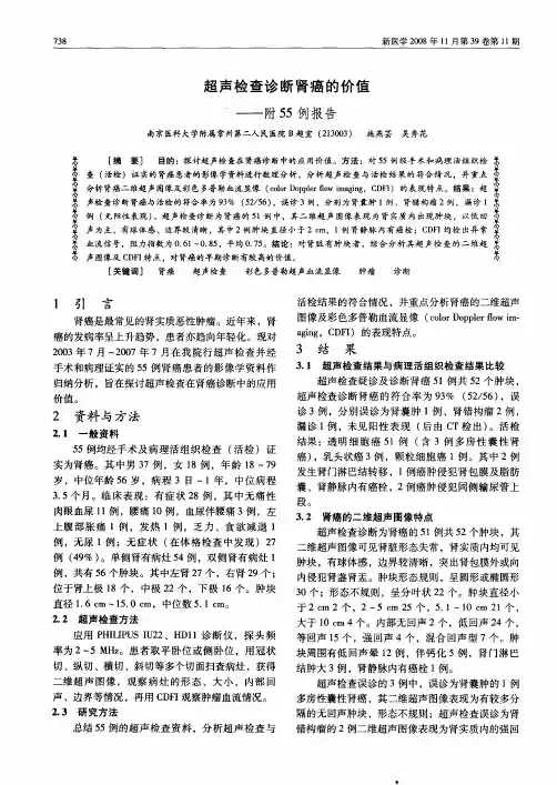 超声检查诊断肾癌的价值——附55例报告