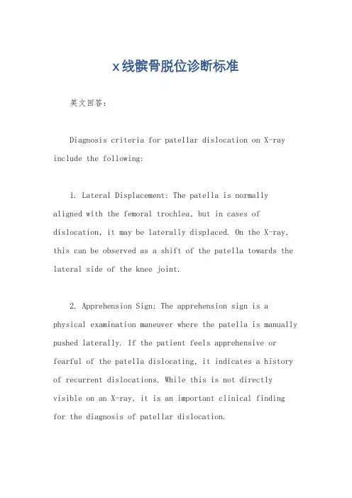x线髌骨脱位诊断标准