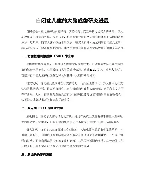 自闭症儿童的大脑成像研究进展