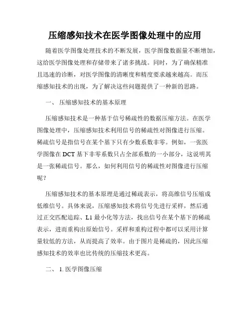 压缩感知技术在医学图像处理中的应用