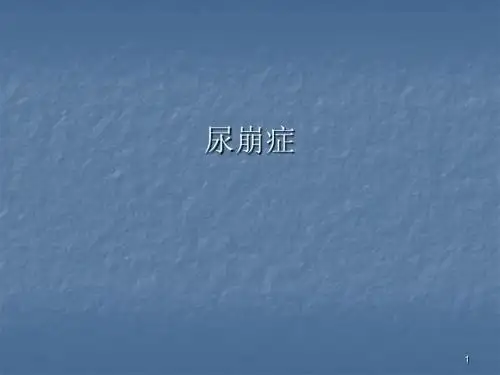 尿崩征ppt课件