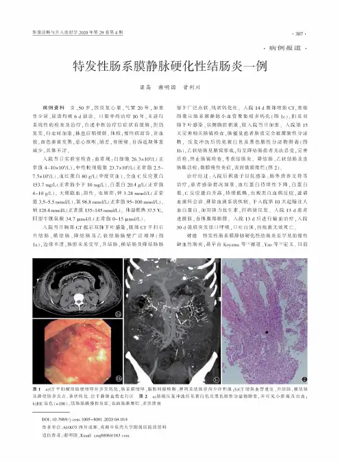 特发性肠系膜静脉硬化性结肠炎一例