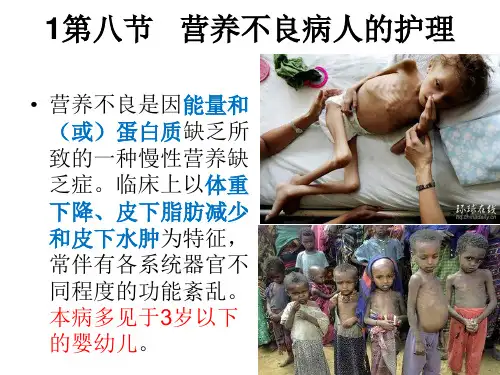 第八节   营养不良病人的护理模板