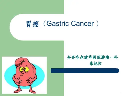 胃癌ppt课件