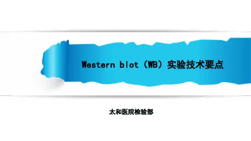 western blot实验技术要点