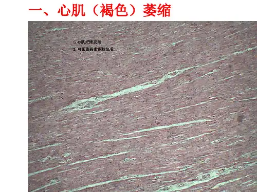 病理切片考试--最完整版