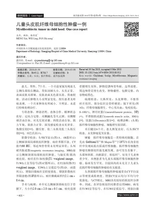 儿童头皮肌纤维母细胞性肿瘤一例