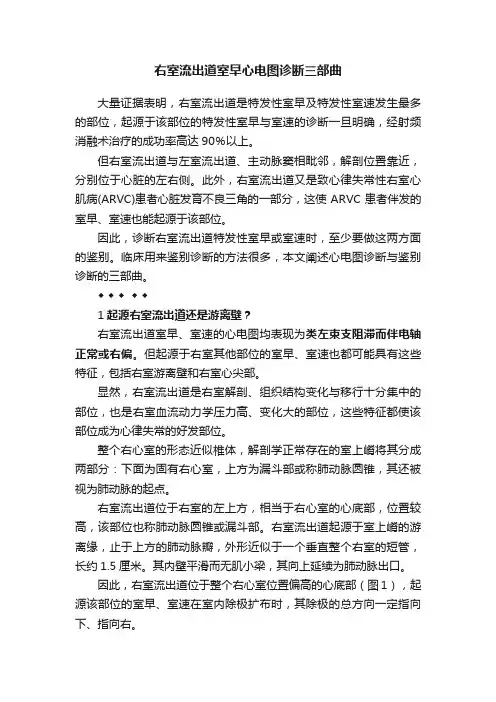 右室流出道室早心电图诊断三部曲