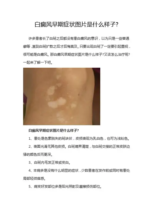 白癜风早期症状图片是什么样子