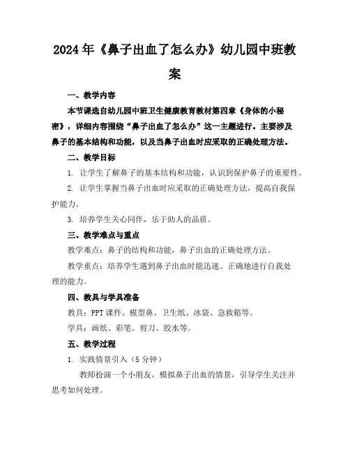 2024年《鼻子出血了怎么办》幼儿园中班教案