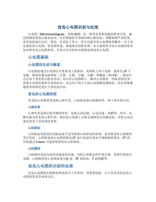 急危心电图识别与处理