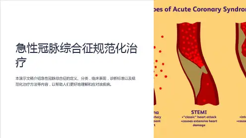 急性冠脉综合征规范化治疗ppt