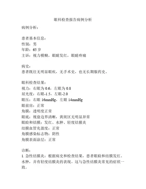 眼科检查报告病例分析