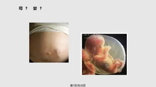 剖宫产麻醉操作规范PPT课件