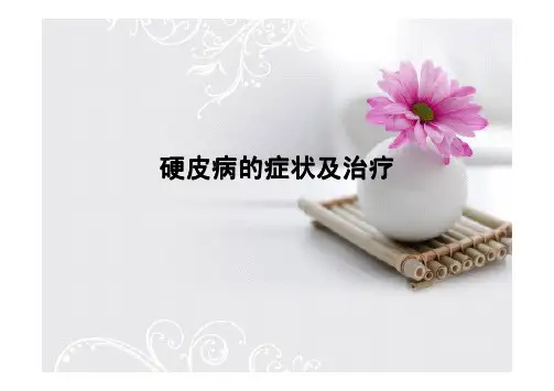 硬皮病的症状及治疗