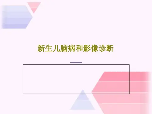 新生儿脑病和影像诊断PPT共51页