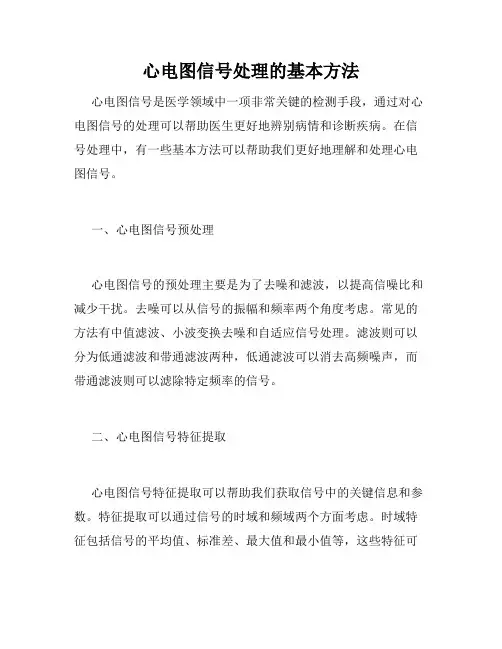 心电图信号处理的基本方法