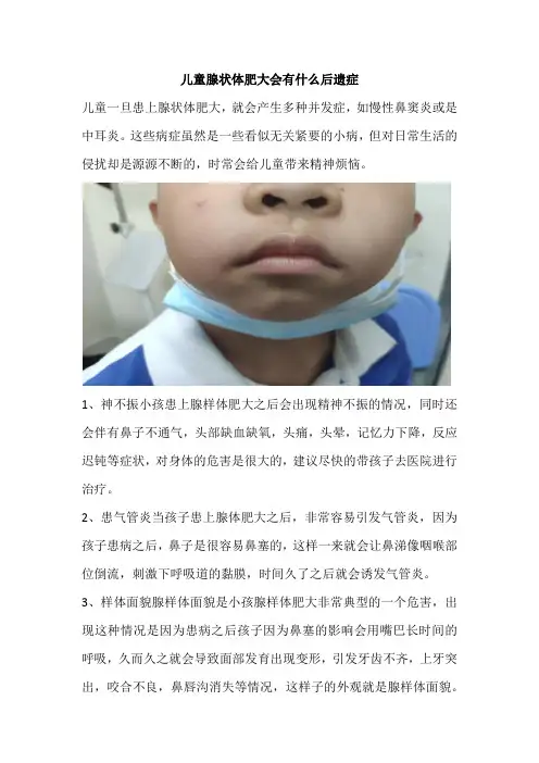 儿童腺状体肥大会有什么后遗症