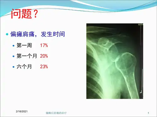 偏瘫后肩痛的治疗课件