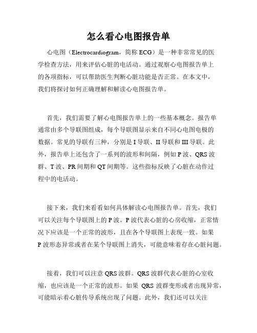 怎么看心电图报告单
