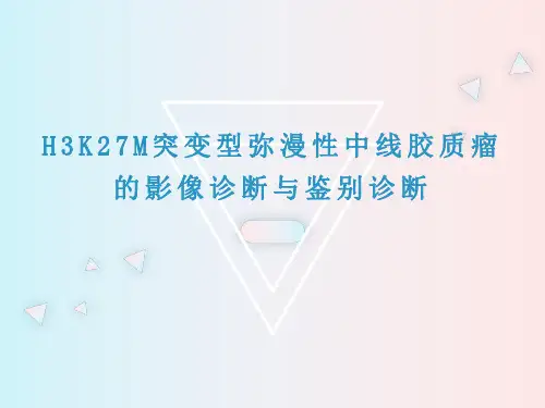 H3K27M突变型弥漫性中线胶质瘤的影像诊断与鉴别诊断