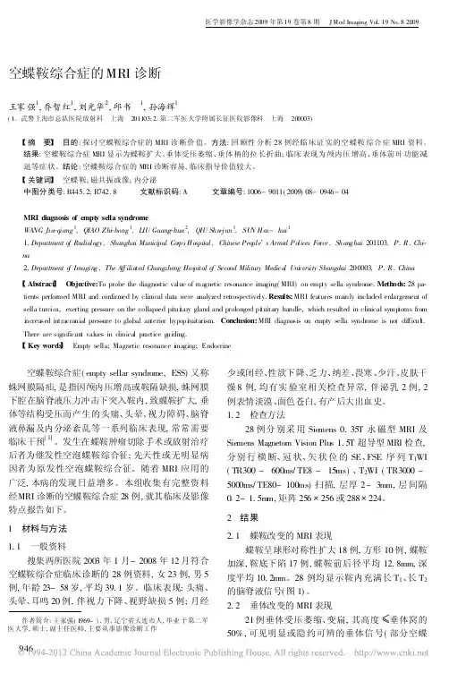 空蝶鞍综合症的MRI诊断_王家强