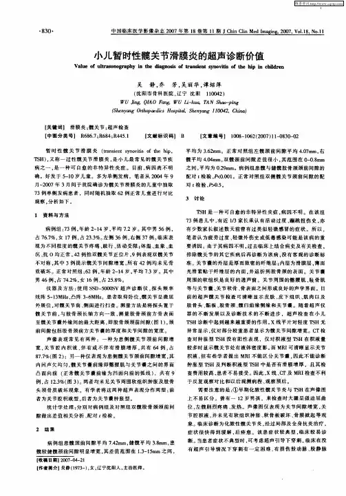 小儿暂时性髋关节滑膜炎的超声诊断价值