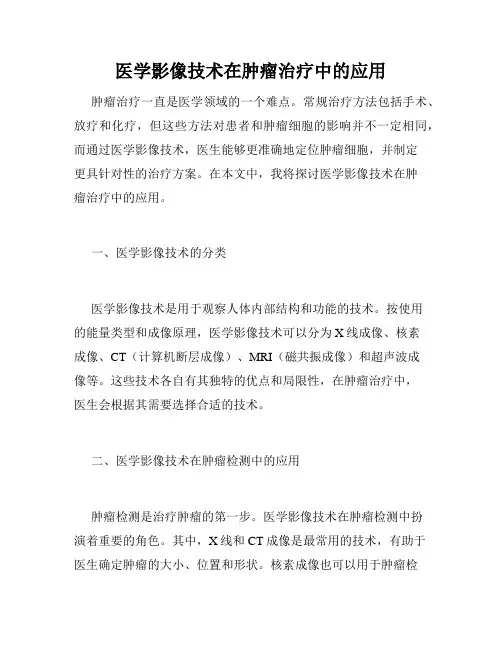 医学影像技术在肿瘤治疗中的应用