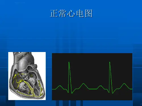 恶性心律失常的诊断及电复律ppt课件