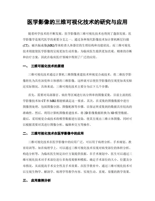 医学影像的三维可视化技术的研究与应用