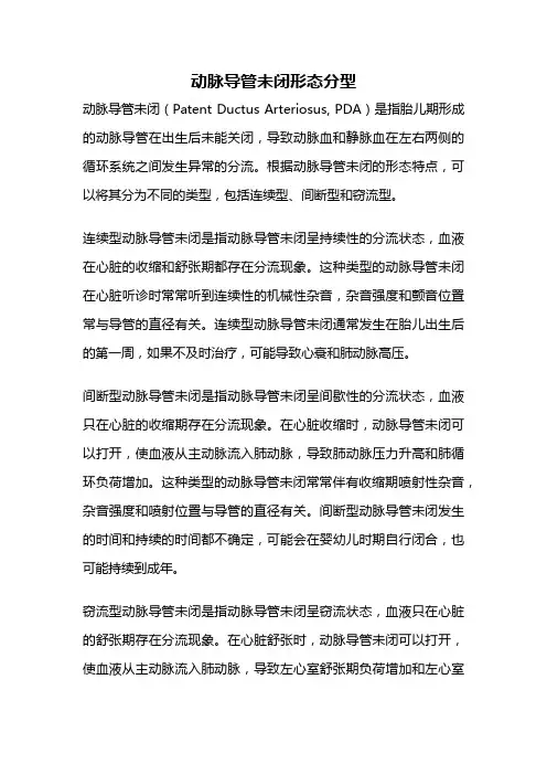 动脉导管未闭形态分型