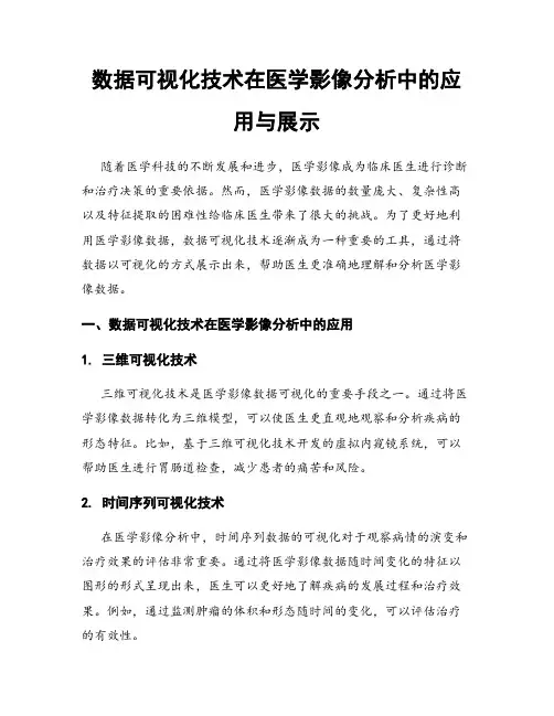 数据可视化技术在医学影像分析中的应用与展示