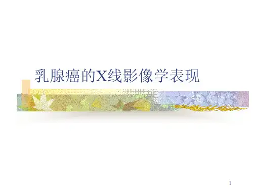 乳腺癌的X线影像学表现
