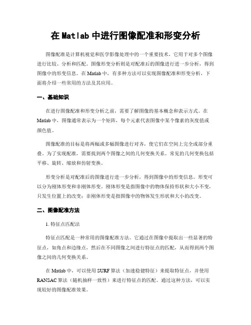 在Matlab中进行图像配准和形变分析