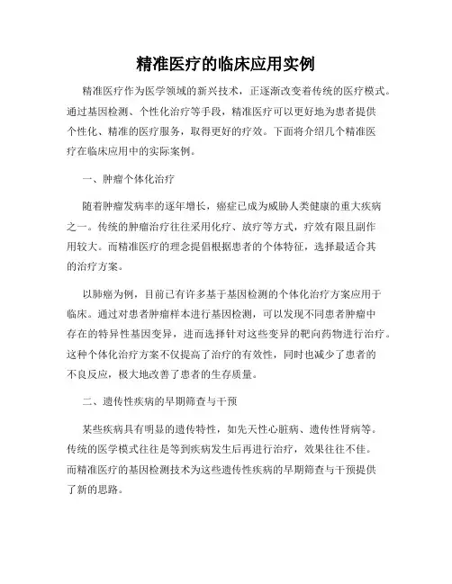精准医疗的临床应用实例