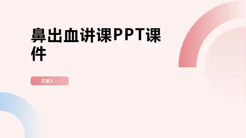 鼻出血讲课PPT课件