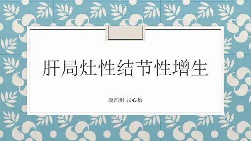 肝局灶性结节性增生