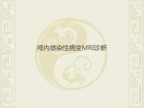 颅内感染性病变MRI诊断