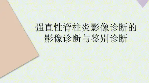 强直性脊柱炎的影像诊断与鉴别诊断