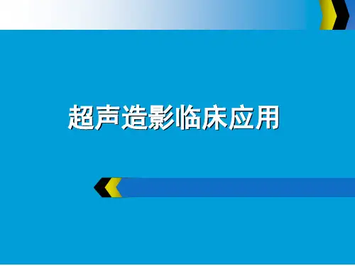 超声造影临床应用