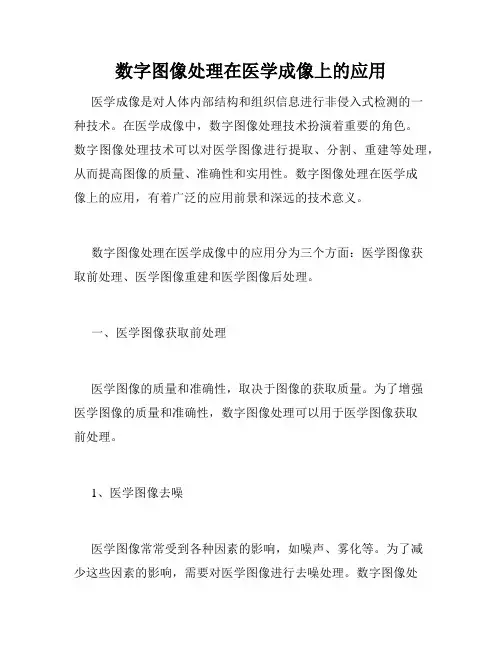 数字图像处理在医学成像上的应用