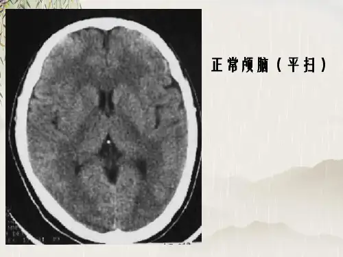 CT诊断教程读片介绍