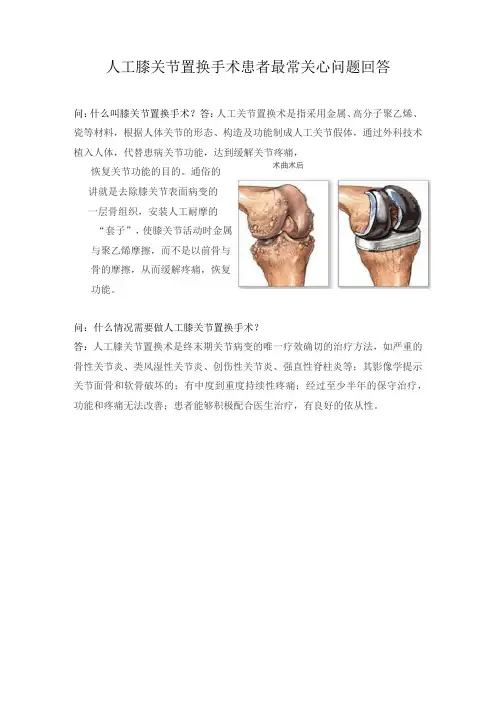 人工膝关节置换术宣教手册范本