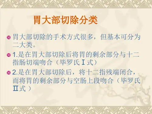 胃大部分切除术