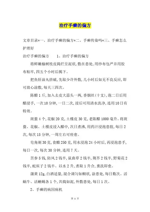 治疗手癣的偏方