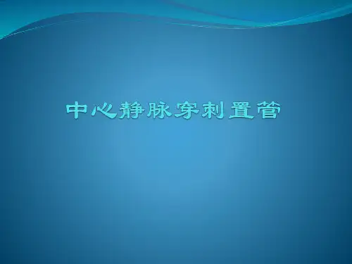 中心静脉穿刺置管