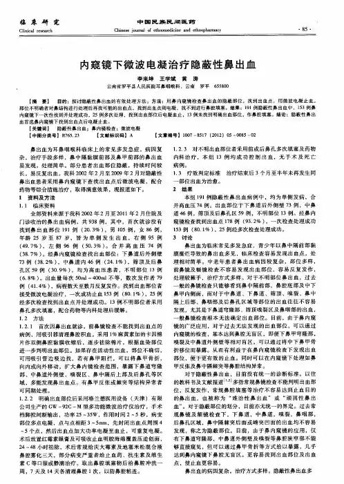内窥镜下微波电凝治疗隐蔽性鼻出血