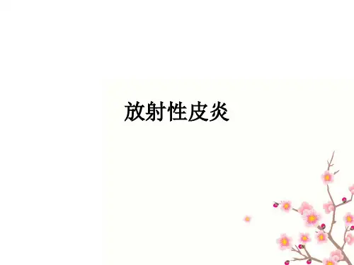 放射性皮炎ppt课件